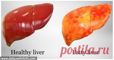 Как избавиться от жирной печени за несколько дней! - Красота, здоровье и мода - Дом 2 свежие серии онлайн, новости, слухи на Белок.Нет