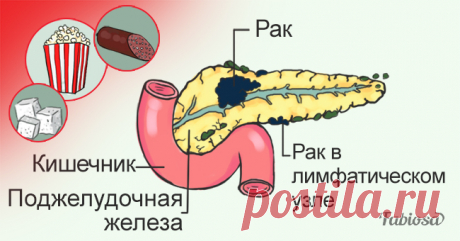 От них лучше отказаться: 10 продуктов, вызывающих рак Лучше перестраховаться и не злоупотреблять этими продуктами.