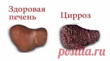 Цирроз печени — лечение травами — Умный совет