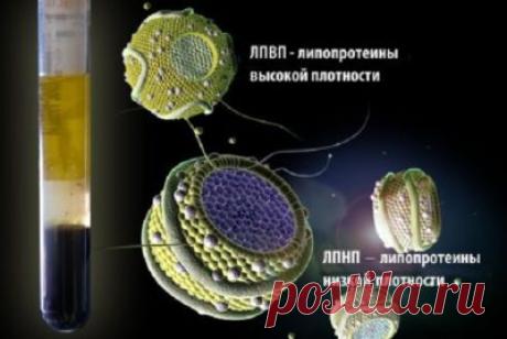 Плохой холестерин: причины его повышения и способы лечения