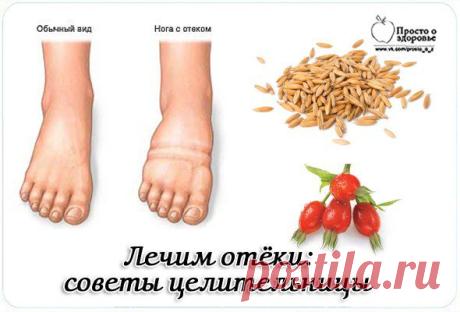 ПРОСТО О ЗДОРОВЬЕ✔