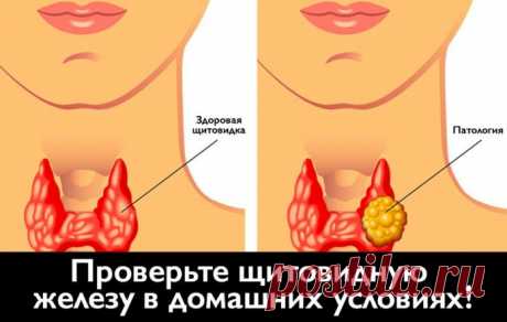 Проверьте щитовидную железу в домашних условиях с помощью этого простого теста!