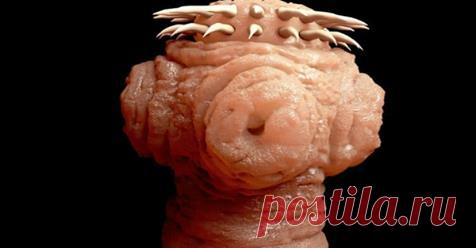 Удивительно: вы можете иметь это в своем теле, не осознавая этого (и это причина, по которой вы не теряете вес)