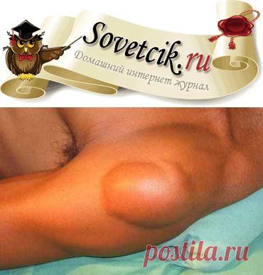 Лечение липомы, жировиков народными средствами | Sovetcik.ru