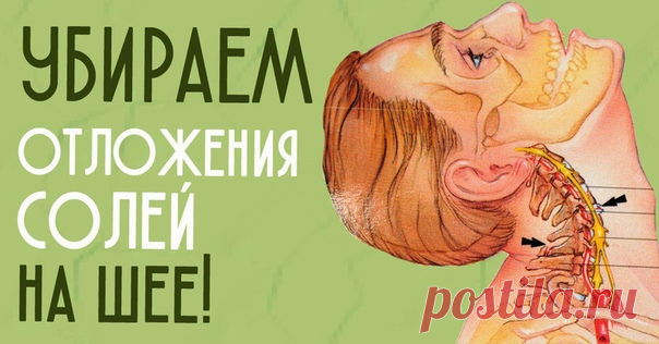 Это мощнейшее средство эффективно уберет отложения солей на шее!
На шейную область приготовьте компресс:
...
Читaть продолжение…