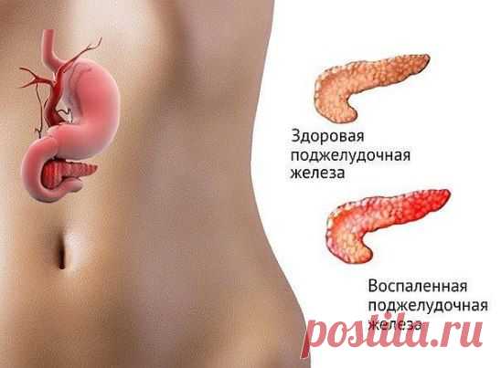 Если беспокоит поджелудочная железа.
Есть способ не только облегчить страдания, но и навсегда забыть о этой напасти..... Это семя льна..., оно единственное! способно вылечить вашу поджелудочную железу. 
Нужно: 
Свежемолотую столовую ложку семян льна заварить 0,5 стакана кипятка.... Дать потомиться на слабом огне 5 минут при закрытой крышке и оставить остывать в таком состоянии..... а тёпленьким, как остынет - выпить этот киселек вместе со всеми шелушками от семени за 30 минут до основного при