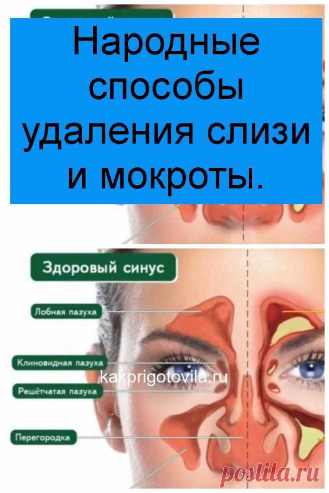 Народные способы удаления слизи и мокроты.