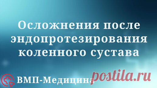 Осложнения после эндопротезирования коленного сустава | ВМП-Медицина | ВМП-Медицина | Дзен