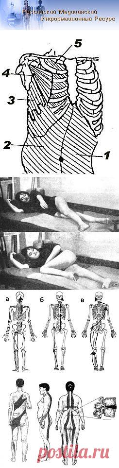 Медицинская информация. Скачать книги по медицине. - 5.2. Цепной миотатический рефлекс