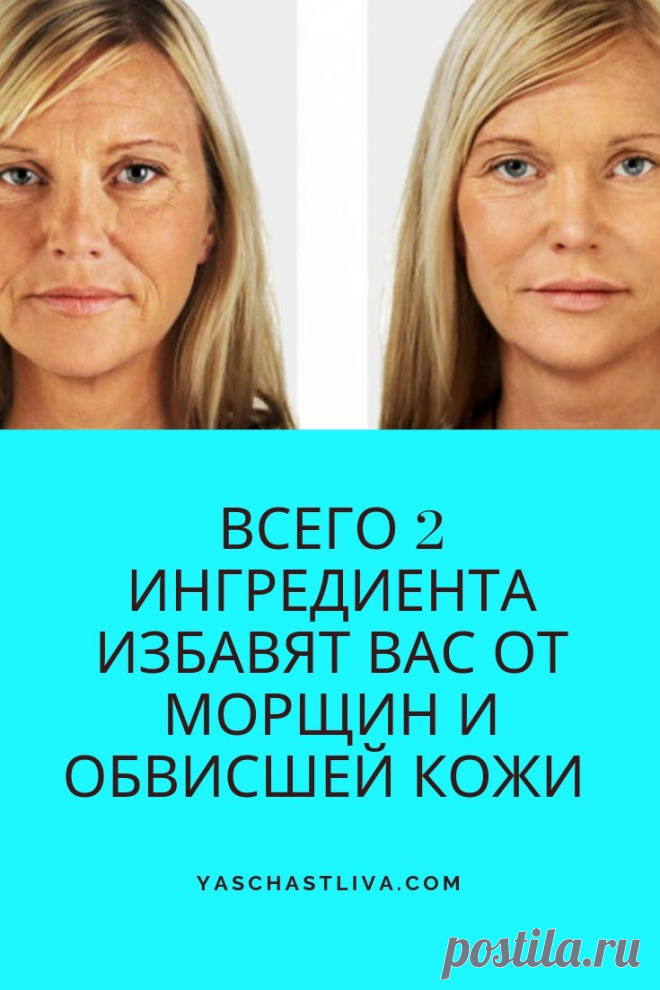 Всего 2 ингредиента избавят вас от морщин и обвисшей кожи на лице! Стоит попробовать! ➡️ Кликайте на фото, чтобы прочитать статью полностью