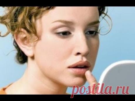 Герпес и вирусы прощайте