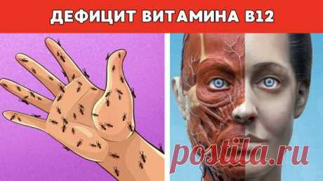7 симптомов дефицита витамина B12, которые никогда не следует игнорировать - ПолонСил.ру - социальная сеть здоровья - 23 февраля - 43567498074 - Медиаплатформа МирТесен Добро пожаловать в удивительный мир витамина B12, где живут магические яйца, курица, говядина и, конечно, добавки! Поговаривают, что без этого волшебного витамина ваше тело может начать вести себя странно, как капризный актер в низкобюджетном фильме. А знаете, почему? Потому что наше тело, как - 23 февраля ...