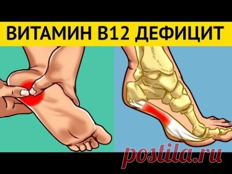 Симптомы Дефицита B12 которые вызывают НЕОБРАТИМЫЕ ПРОЦЕССЫ в организме