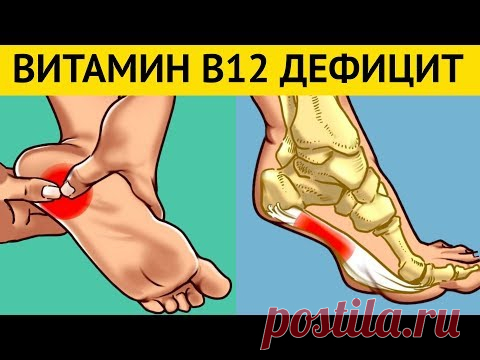 Симптомы Дефицита B12 которые вызывают НЕОБРАТИМЫЕ ПРОЦЕССЫ в организме