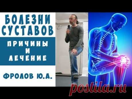 Артриты. Артрозы. Лечение Суставов быстро и надёжно, навсегда. Рецепты, методы от Фролова Ю.А.