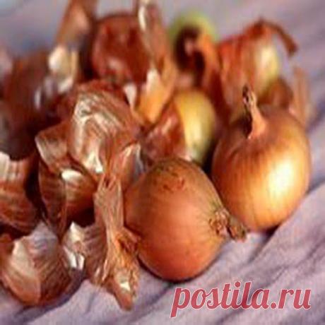 Луковые рецепты для красивых волос | Друг пенсионера
Репчатый лук — одно из самых распро­страненных овощных растений — яв­ляется обладателем необычных биологи­ческих свойств. Среди растений, входящих в проверенные временем рецепты красо­ты, лук занимает далеко не последнее мес­то.
