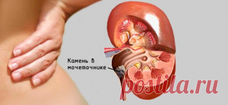 1.Камни в желчном пузыре - звучит как приговор?
2.Как очистить организм от шлаков и токсинов? 5 очищающих напитков.
3.Необыкновенный эффект от умывания ромашкой!
4.Секреты чайного гриба.
5.Синий йод — забытое старое лекарство.
6.Как убрать седину навсегда без окрашивания ! Инновационный метод.