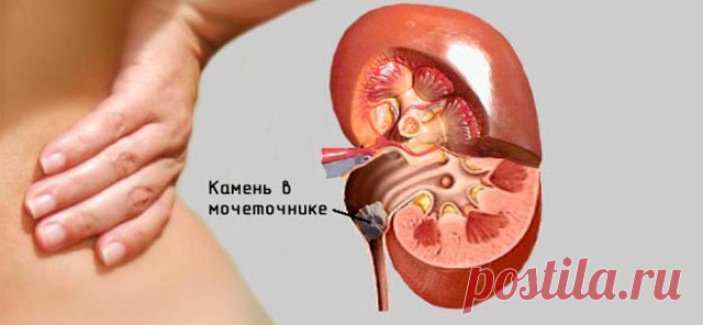 1.Камни в желчном пузыре - звучит как приговор?
2.Как очистить организм от шлаков и токсинов? 5 очищающих напитков.
3.Необыкновенный эффект от умывания ромашкой!
4.Секреты чайного гриба.
5.Синий йод — забытое старое лекарство.
6.Как убрать седину навсегда без окрашивания ! Инновационный метод.