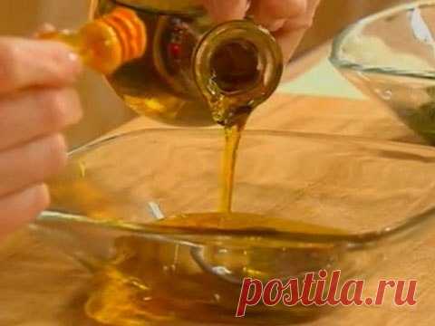 Камни в желчном пузыре