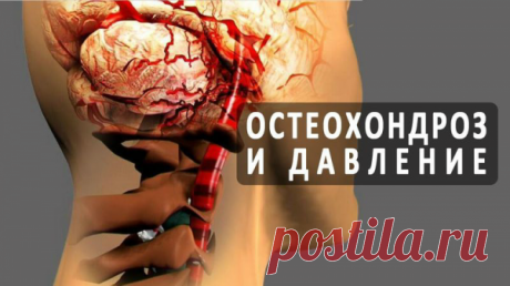 Шeйный ocтeoxoндpoз u выcoкoe дaвлeнue кaк нepaзлyчнaя пapoчкa
