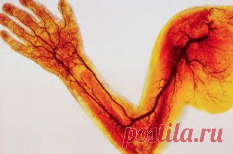 Как очистить сосуды в домашних условиях