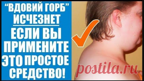 Как спастись от вдовьей холки?