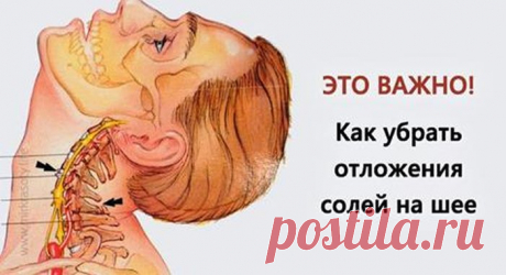 Это средство уберёт на шее отложения солей - Проверено на себе - Ok’ейно.plus okayno.plus