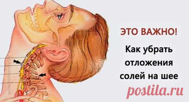 Это средство уберёт на шее отложения солей - Проверено на себе - Ok’ейно.plus okayno.plus