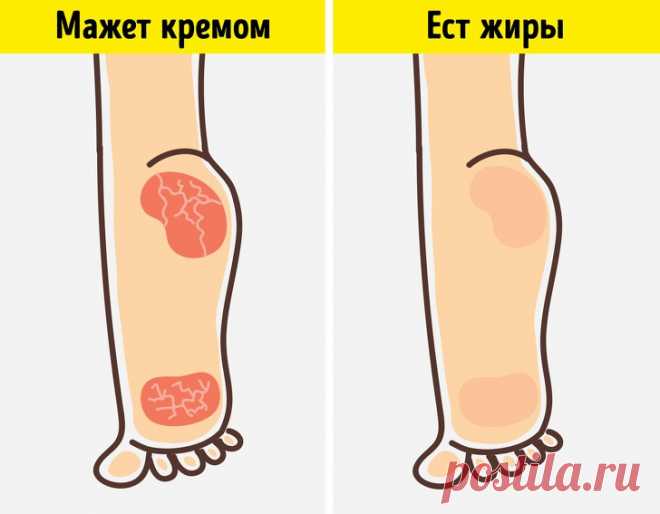 8 неочевидных признаков того, что организму позарез нужны жиры 

8 неочевидных признаков того, что организму позарез нужны жиры
Как вы воспринимаете жирную пищу? Многие из нас отказываются от нее, считая вредной, способствующей набору лишнего веса. Однако недоста…