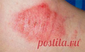 Обсуждения - ЗЕЛЕНЫЙ ДОКТОР (народные методы лечения) - Группы Мой Мир