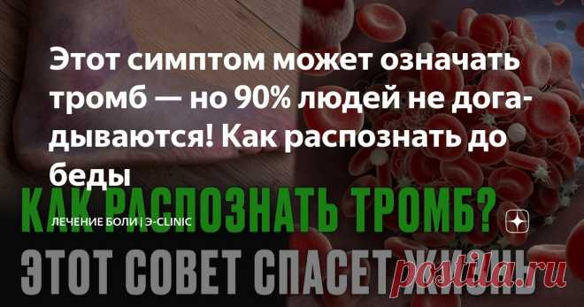 Этот симптом может означать тромб — но 90% людей не догадываются! Как распознать до беды Статья автора «Лечение боли» в Дзене ✍: Вчера мой сосед по даче, здоровый мужик лет пятидесяти, внезапно упал на огороде. Я подбежал — дышит тяжело, хватается за грудь. Скорая увезла в реанимацию.
