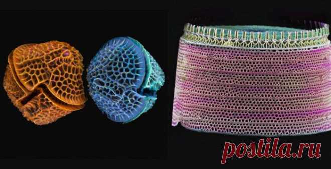 водоросли под микроскопом - Поиск в Google