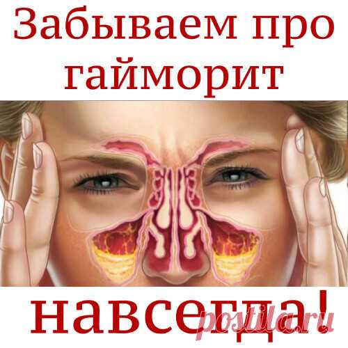 Забываем про гайморит навсегда!