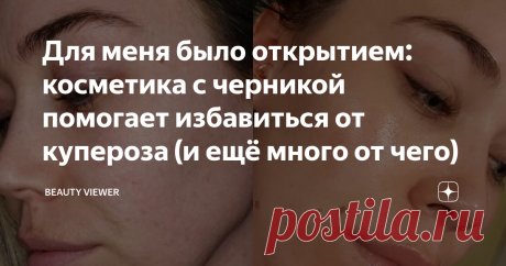 Для меня было открытием: косметика с черникой помогает избавиться от купероза (и ещё много от чего) Сколько уже было материалов о супер-способностях гиалуроновой кислоты, ниацинамида и ретинолов - не пересчитать. Давайте поговорим о более приземлённых компонентах в косметике, которые работают с кожей ничуть не хуже новомодной синтетики, над которыми трудились великие умы в химии от Лондона до Парижа.
Начнём мы с черники. Известная всему миру ягода, но о том, как она улучшает нашу кожу даже в