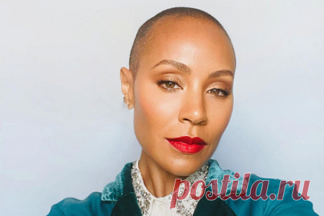 Жена Уилла Смита раскрыла причину лысины на своей голове. Жена голливудского актера Уилла Смита Джада Пинкетт-Смит раскрыла причины отсутствия волос на голове. В описании к видео женщина призналась, что страдает от алопеции. По ее словам, она решила откровенно высказаться по поводу своей прически, чтобы не провоцировать слухи о наличии у нее какого-либо заболевания.