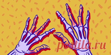 Откуда берётся ревматоидный артрит, можно ли его предотвратить и как лечить Мария Дронова. 31 мая 2020. Если вовремя не обратиться к врачу, может понадобиться операция. Что такое ревматоидный артрит. Ревматоидный артрит — это хроническое воспалительное заболевание, при котором иммунная система по ошибке атакует здоровые клетки организма. Страдают в основном только суставы — кисти, запястья, колени. Но иногда ревматоидный артрит влияет Rheumatoid arthritis ещё и на лёгкие, ...