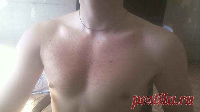 Классический: Красные пятна на груди: причины и лечение Появление красных пятен на любой части тела, и особенно на груди, очень настораживает любого человека. Причин их появления довольно много.