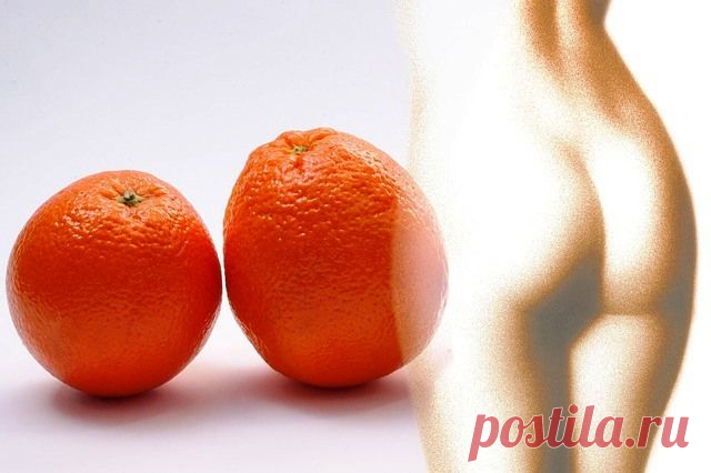 КАК ИЗБАВИТЬСЯ ОТ ЦЕЛЛЮЛИТА, ТРАТЯ 10 МИНУТ В ДЕНЬ

Снимаем «апельсиновую корку» с бедер и ягодиц.

Целлюлит — это проблема всего организма. И проблема эта не возникает в один день. Подобно морщинам или избыточному весу, она развивается постепенно и незаметно. Для того чтобы с ней справиться, нужно, в первую очередь, изучить весь курс методов и средств воздействия на организм, которые основаны на знании физиологии человека.