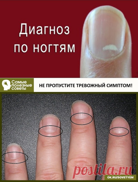 Одноклассники