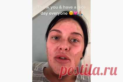 Женщина попыталась приготовить яйца по рецепту из TikTok и получила ожоги лица. Блогерша из Великобритании по имени Шантель Конуэй (Chantelle Conway) рассказала о том, как попыталась приготовить яйца по рецепту из TikTok. В нескольких видео 25-летняя женщина рассказала, как в результате получила ожоги лица, и предупредила других пользователей об опасности кулинарного лайфхака.