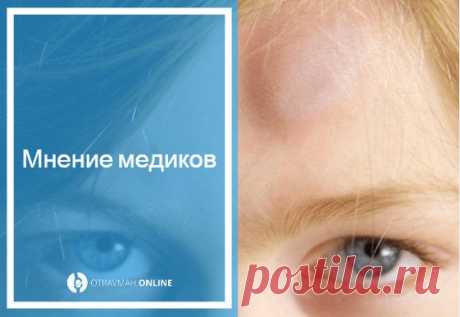 Мазь для детей от ушибов и синяков 🔎 - обезболивающее средство