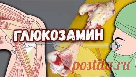 Говяжья кость вместо дорогого лекарства. Глюкозамин в чистом виде. Говяжья кость содержит вещество глюкозамин, из которого делают лекарство. Можно употреблять его в чистом виде, 
отваривая эту кость в течение 6 часов и пить бульон в теплом виде по пол стакана 2-3 раза в день. 
Продолжительность курса — не менее трех месяцев. В этот бульон можно добавлять вкусовые добавки (соль, перец, 
приправы). Очень эффективное средство при проблемах с суставами или костями. Незаменимо ...