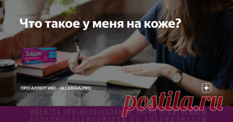 Что такое у меня на коже? В среднем у 20 % аллергиков могут встречаться симптомы аллергии в виде проявлений на коже [1]. Не стоит забывать, что кожные реакции могут быть многообразны и не всегда связаны с нежелательным ответом на аллерген. Рассказываем, почему не все пятна на коже — аллергия и не вся аллергия связана с кожными проявлениями. Образования на коже могут отличаться друг от друга как внешним видом, так и механизмом появления. Если на каком-то участке кожи измени...
