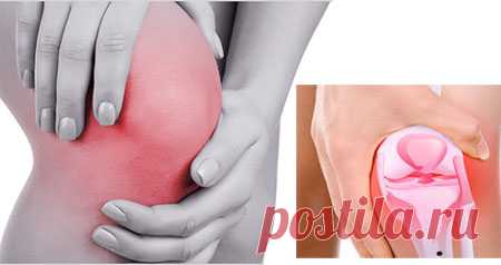 Бурсит коленного сустава - симптомы и лечение, фото, причины | Здрав-Лаб