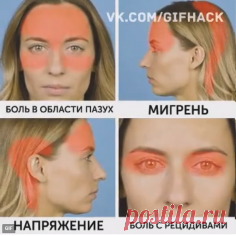 Акупрессура. Расположение акупунктурных точек от болей