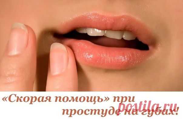 «СКОРАЯ ПОМОЩЬ» ПРИ ПРОСТУДЕ НА ГУБАХ!