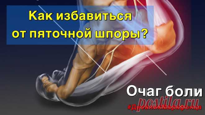 Утренняя боль в пятке. Пяточная шпора. Дневник марафонца. Утренняя боль в пятке. Пяточная шпора. Дневник марафонца. Даю 3 эффективных упражнения благодаря которым я избавился от этого «шипа».
