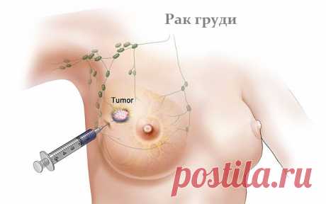 Лучшие суперпродукты, которые помогают бороться с раком молочной железы!