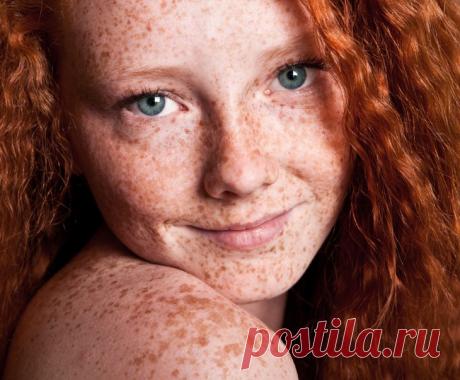 Эта фраза разрушила все мои комплексы по поводу внешности! | Чёрт побери Пожалуй, в мире не найдется человека, который был бы полностью доволен своим внешним видом. Тем более, что многих в детстве дразнили, например, из-за длинного носа или высокого роста. Но любые недостатки можно превратить в достоинства! А мы уверены, что от детских комплексов нужно избавляться. Вот одной девушке помог расправиться с ними совершенно незнакомый мужчина!  Всю жизнь у меня были веснушки. И...