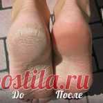 СРЕДСТВО для ПЯТОЧЕК: